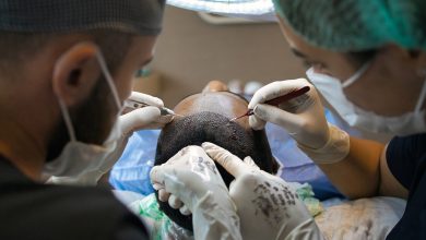 What is a Hair Graft and How is it Created?