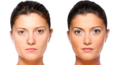 Facials Before and After: What to Expect and Why They Work